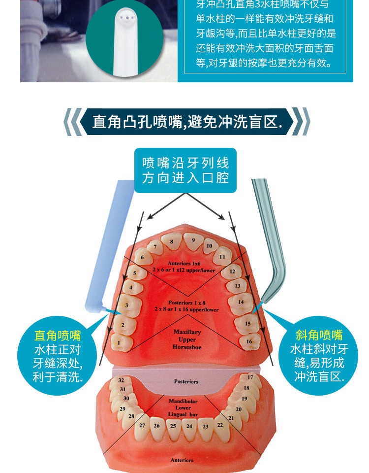 洁牙器械认识图片