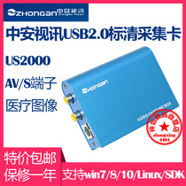 Zhongan Video US2000 SD acquisition card AV s terminal medical B ultrasound image USB external old Tape Transcription