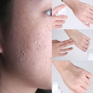 去角质素喷雾女男全身手足脸面部身体啫喱去死皮黑头鸡皮肤磨砂膏