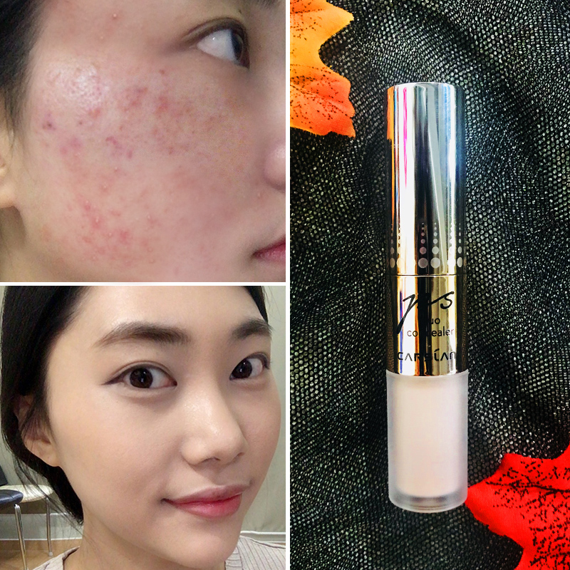 卡姿兰遮瑕膏痘印遮盖痘痘脸部雀斑点遮瑕笔保湿防水正品遮瑕液盘_7折