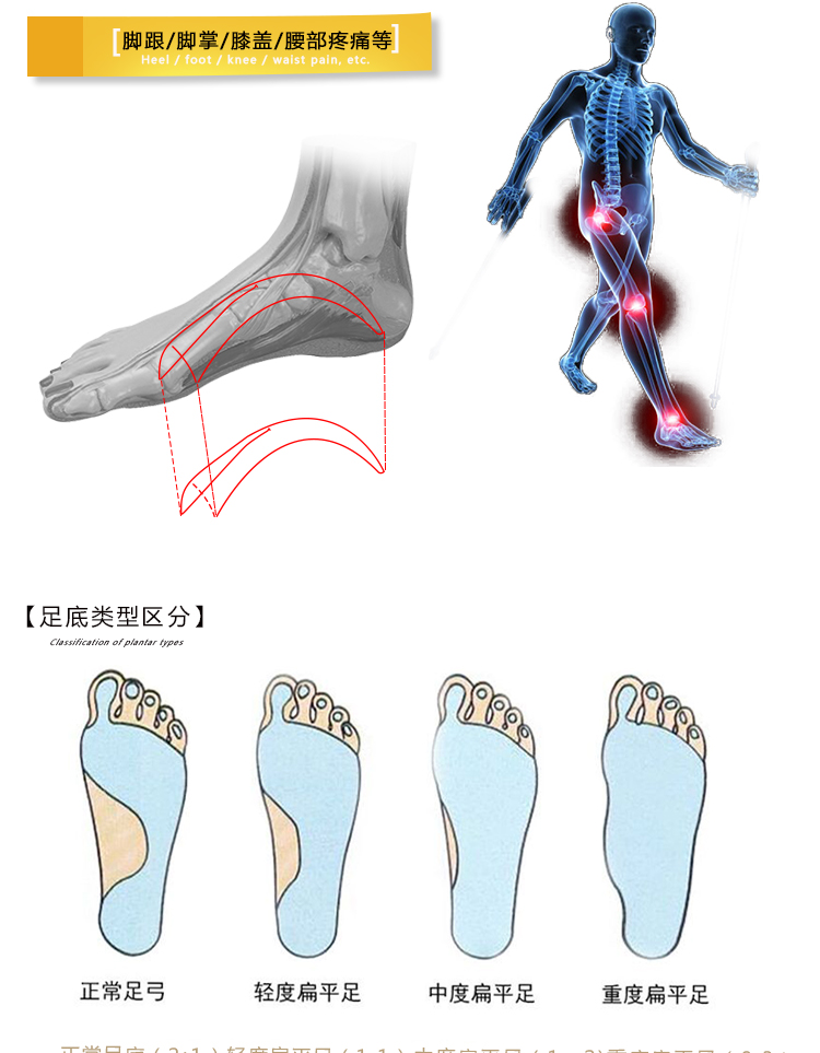 扁平足矫正鞋垫成人男女内八字x型腿足外翻平板脚高弓