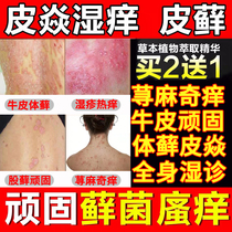 Beikang official website Meimei Magnesium Zhenren Nuokang Kefu Baokang Baocao Fu Baoling flagship store Leidoshu ointment