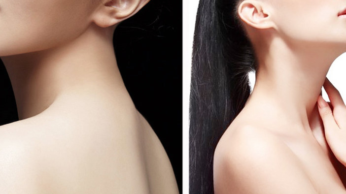 颈膜为你打造白皙性感天鹅颈