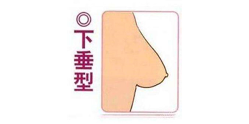 这种胸型乳头比较低,乳房快要碰到胸部,看起来没有一点生气,很多哺乳