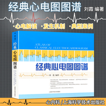 On-the-spot spot medical electrocardiogram book book entry Classic electrocardiogram map simple easy to learn practical clinical diagnosis map Liu Xia edited Shanghai Science and Technology Press 978754780