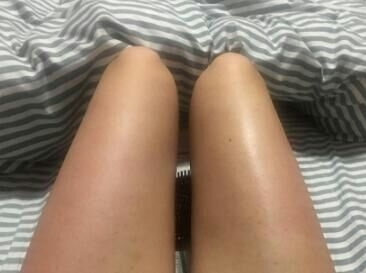 确实有起到淡化的作用了呢，之前和现在比完全都不一样了，喜欢这款宝贝，用了这么久了也没出现过敏的现象，可以可以，这瓶用完了，还会再来买的。太喜欢了。