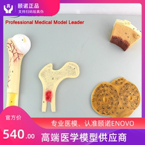 ENOVO Yinuo bone structure model vascular cancellous bone and femoral Haver system Human Bone