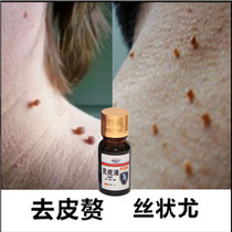 Herbal wart cream keyoujing wart cream rare grass worry cream keyouwang keyou liquid flat filamentous cream