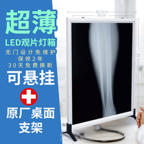 X-ray film viewing light Medical led ultra-thin film viewing light Reading light Single dental double orthopedic film viewing light box