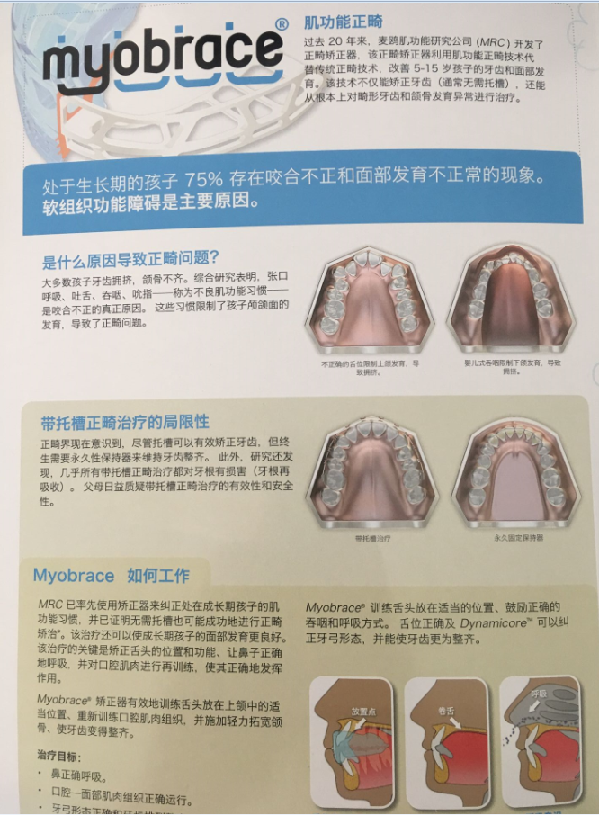 儿童牙齿矫正器mrc纠正不齐地包天反颌外凸错位口呼吸
