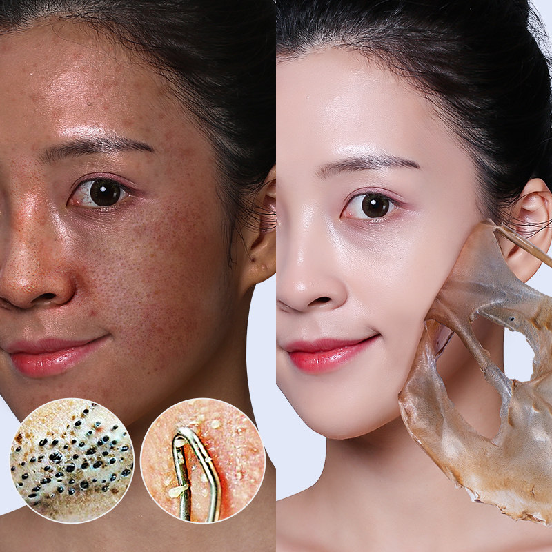 去脏脸神器 撕出脏东西 面部深层清洁污垢脸部去毛孔垃圾清洁膏