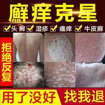 (Uprooting) Psoriasis Psoriasis Eczema Dermatosis Treatment Stop Itch to root hand foot stock Ointment External cream S