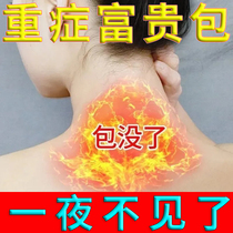 Go to rich and expensive bag dredge cervical spine special elimination post neck massage for external repair correction Divine Instrumental Paste S