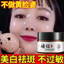 Whitening Plaque Cream Geriatric powerful removal of freckles yellow brown spot Flagship Store Color Spot to Spotted Gods S.