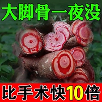 Pass the tip of the large toe to correct the deformity of the foot and overlap joint pain special paste