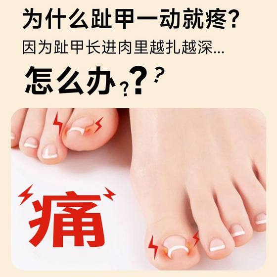 접착제가없는 손톱 패치 네일 삽입 및 손톱 발톱의 수정 도구를 점차적으로 수정하기위한 패치 하나 접착제가없는 손톱 패치 네일 삽입 및 손톱 발톱의 수정 도구를 점차적으로 수정하기위한 패치 하나
