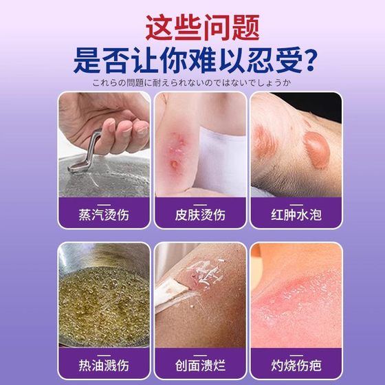 일본 특수 효과 Scald Cream Moist and Burn 특수 효과 제품 흉터 및 화상 증기 Scald 보호 기능 11 일본 특수 효과 Scald Cream Moist and Burn 특수 효과 제품 흉터 및 화상 증기 Scald 보호 기능 11