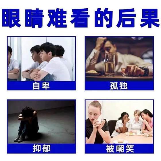 눈꺼풀 처짐 및 리프팅 이중 눈꺼풀 유물 노인이 느슨하고 단단하다면 어떻게해야합니까? 붓기를 제거하고 상단 눈꺼풀을 형성하는 데 특별합니다 눈꺼풀 처짐 및 리프팅 이중 눈꺼풀 유물 노인이 느슨하고 단단하다면 어떻게해야합니까? 붓기를 제거하고 상단 눈꺼풀을 형성하는 데 특별합니다