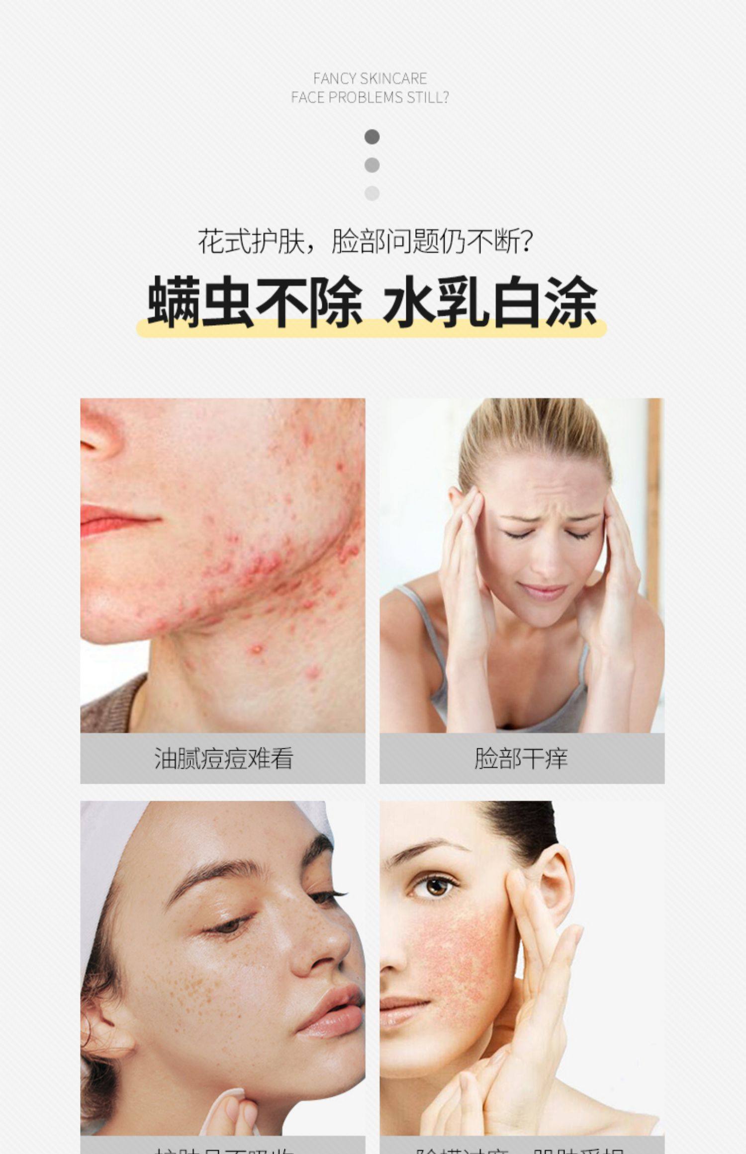 丝芬祛痘除螨皂洗脸控油男女面部后背全身苦参海盐净螨虫美背香皂