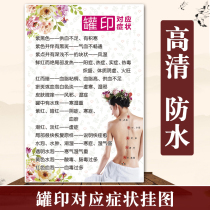 Traditional Chinese medicine health picture wall chart poster beauty salon poster Meridians decorative painting Cupping print corresponding symptoms and symptoms