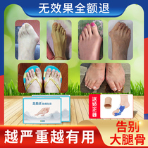 Thumbs valgus orthotics hallux valgus sticking head separation correction toe orthotics for men and women