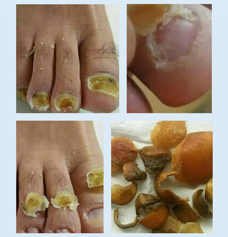 脱甲精油脱甲液甲清去除软甲膏 优惠推荐