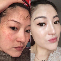 (Centennial Tongrentang) Tongrentang to dispel the speck and to remove the brown and brown spotted senile plaque fading out of the color.