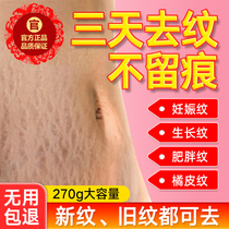 Pregnant womens special prevention and removal of pregnancy and stretch marks postpartum repair cream fades and eliminates obesity growth marks artifact
