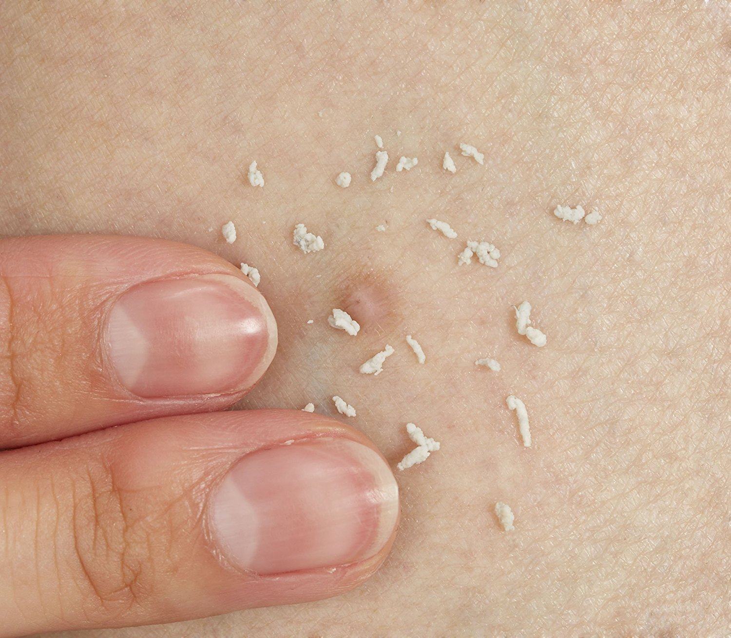 日本制代购女士专用去除淡化眼部颈部凸起脂肪粒角质粒油脂粒15g