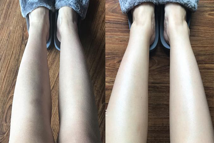 亲测果酸丝滑身体乳,和毛周角化说再见 图4