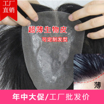 Biological scalp wig Male handsome Korean version Short hair Forehead incognito Mediterranean head hair patch Full real hair Long hair