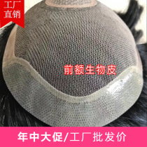 Mens wig piece Forehead invisible hair patch Head top Realistic real hair Mediterranean biological scalp incognito hair patch male