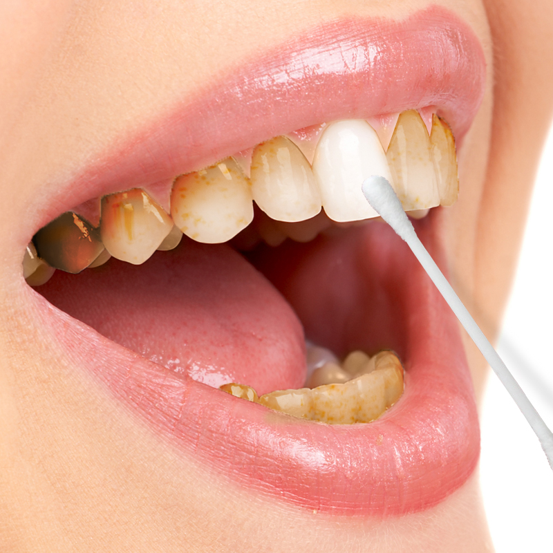 齿白唇红 速效牙齿美白洁白牙齿去牙渍 买二送一_7折现价29.9元