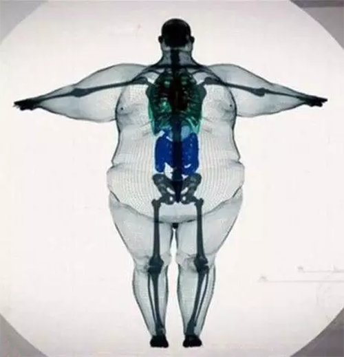 不是胖是骨架大的图片图片