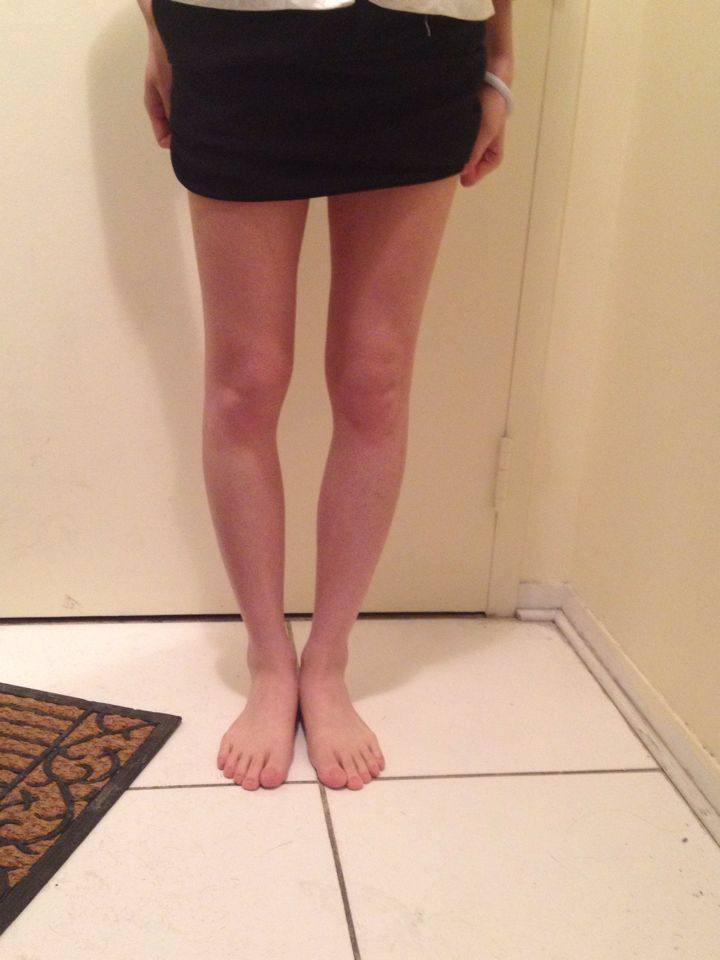 腿型比粗细重要,原来我们一直不知道?