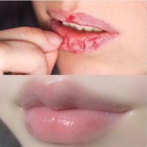 (2019 Jelly Lip Mask) Apply beautiful lips moist lips cute lips and mouth is not dry and cracked