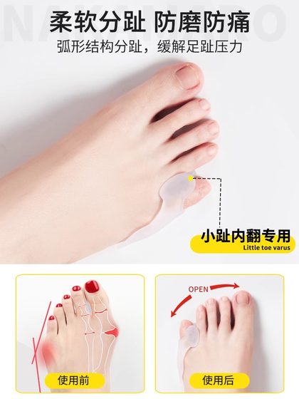 독일 엄지 valgus 교정기 큰 발 뼈 발가락 분리 통기 조절 가능한 발가락 방지 피트 독일 엄지 valgus 교정기 큰 발 뼈 발가락 분리 통기 조절 가능한 발가락 방지 피트