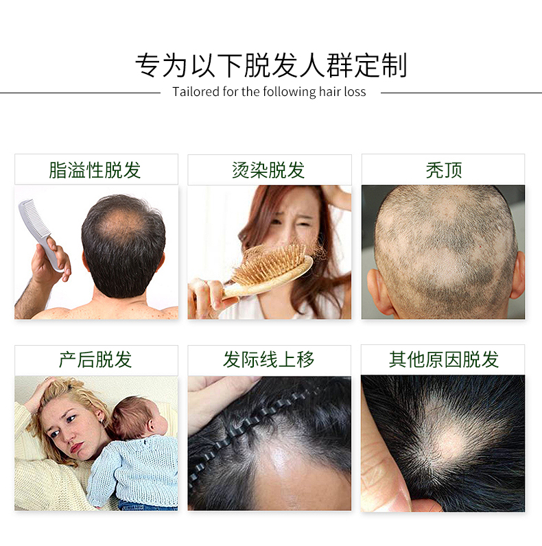 【长发神器】头发长得快变密3-5倍自然生长速