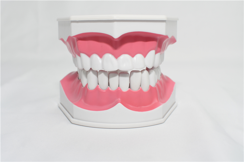 1逼真牙齿模型送牙刷【推荐】,升级带蛀牙模型,1:1套装2个 蛀牙与正常