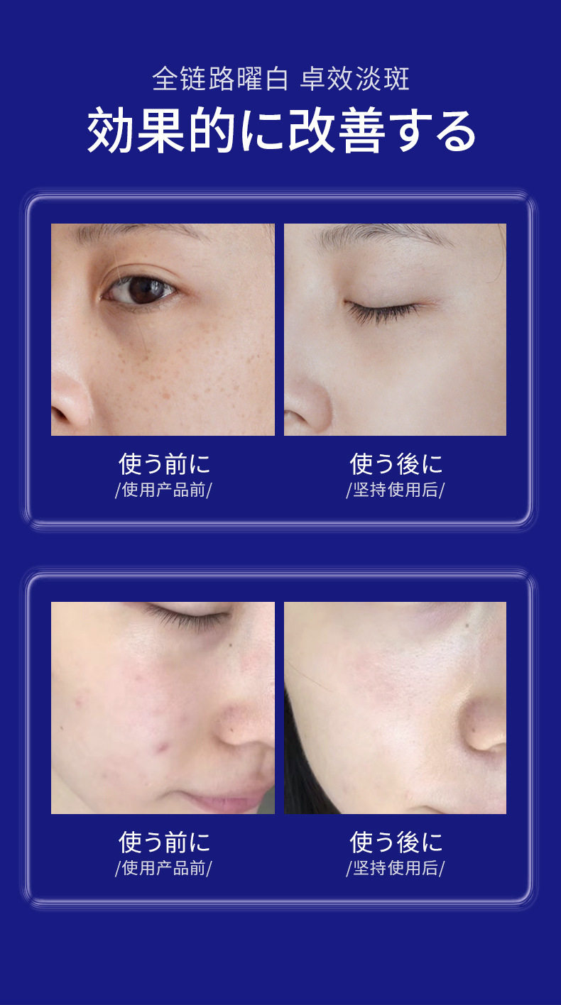 85127-UCM Отбеливание кожи с отбеливанием кожи Essence_04