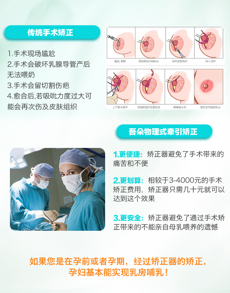 吾朵乳头矫正器乳头牵引器乳头内陷矫正器 专业矫正乳头内陷_7折现价