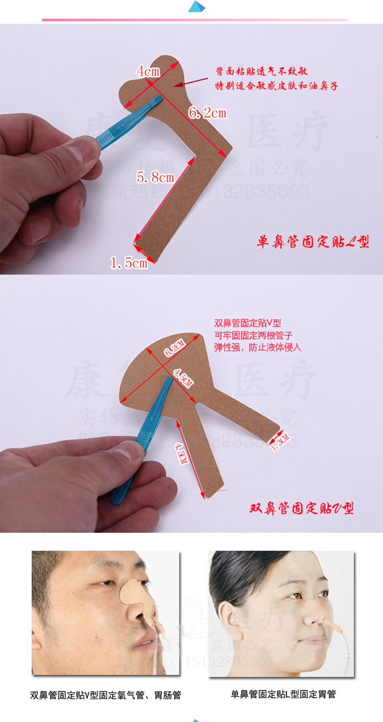两种形状胶布固定胃管法的应用与比较
