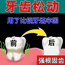 Tooth loosening and fixing teeth repairing periodontal pain medicine tooth shaking gum swelling pain shrinking bleeding nursing special toothpaste