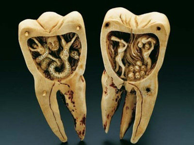 牙膏还是含氟好,可不要因噎忘食