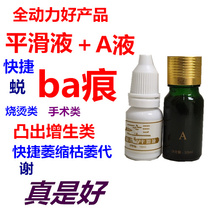 Physical store fist goods Professional use a variety of old and new scalding surgery protruding hyperplasia ba marks quickly wither and retreat