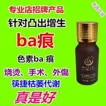 Physical store fist goods Professional solution of various surgical scalding caesarean section hyperplasia protruding ba marks Quick wilt and retreat