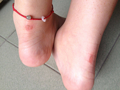 新鞋一穿就磨脚后跟?用这一招再也不疼!