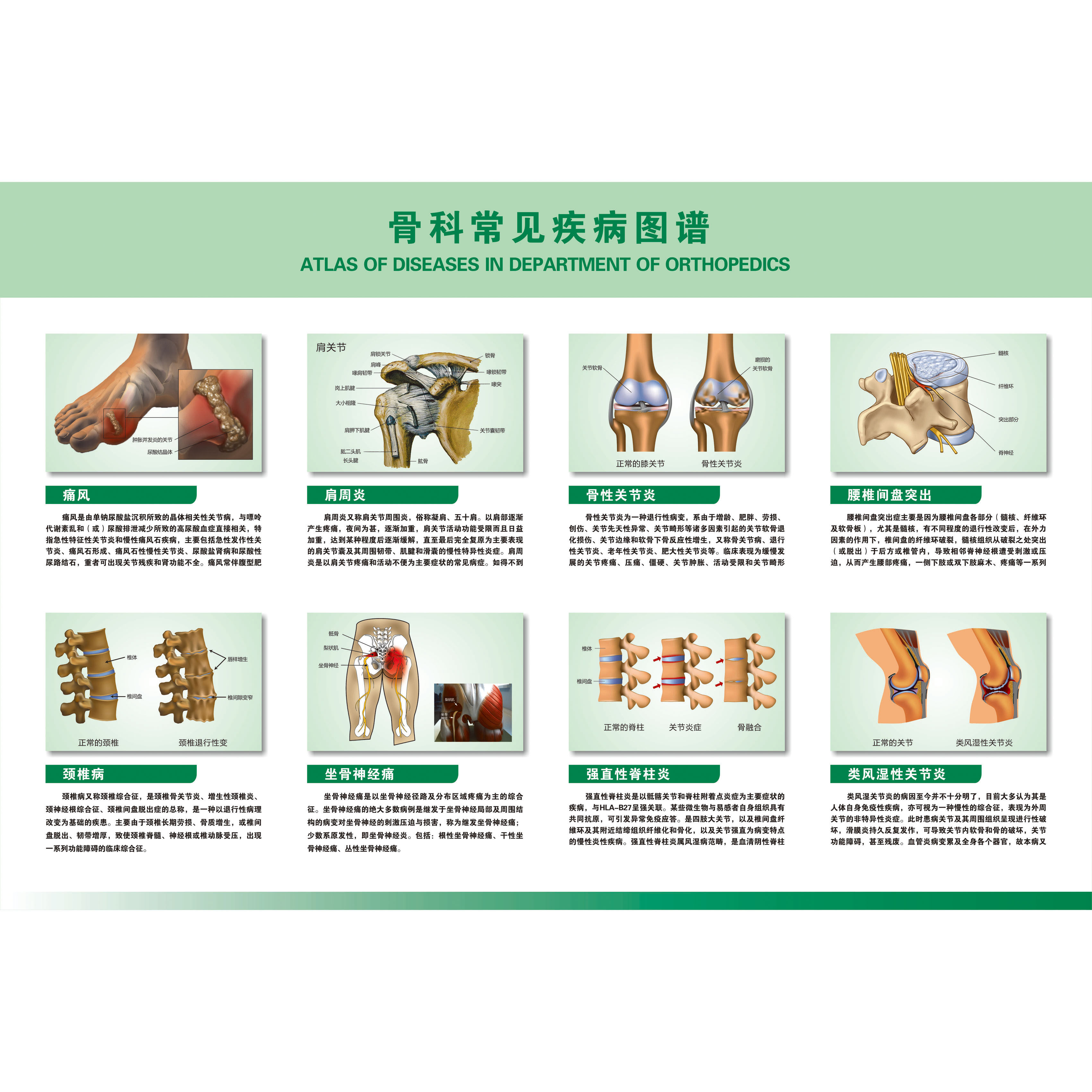 医学骨科挂图 人体骨骼结构展板 人体解剖海报 骨科常见疾病图谱