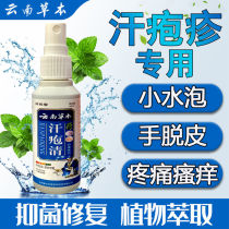 (小水泡)汗疱疹小水泡手上脚上小水泡手出汗脱皮手脚瘙痒湿