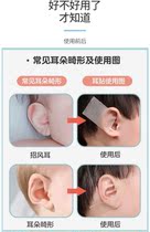 Auricle corrector tape childrens auricle to attract wind ear corrector baby deformed ear to correct babys earlobe